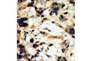 Image no. 1 for anti-serum/glucocorticoid Regulated Kinase 2 (SGK2) (C-Term) antibody (ABIN360349)
