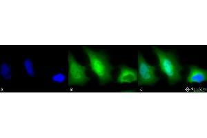 Immunocytochemistry/Immunofluorescence analysis using Rabbit Anti-SOD (Cu/Zn) Polyclonal Antibody . (SOD1 anticorps  (FITC))