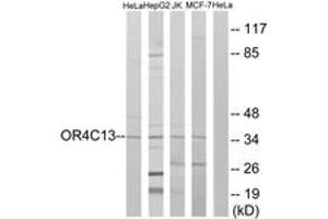Western blot analysis of extracts from HeLa/Jurkat/HepG2/MCF-7 cells, using OR4C13 Antibody. (OR4C13 anticorps  (AA 260-309))