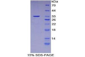 SDS-PAGE (SDS) image for CASP8 and FADD-Like Apoptosis Regulator (CFLAR) (AA 210-460) protein (His tag) (ABIN1878971)