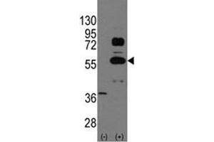 Western blot analysis of SOX9 antibody and 293 cell lysate (2 ug/lane) either nontransfected (Lane 1) or transiently transfected with the SOX9 gene (2).