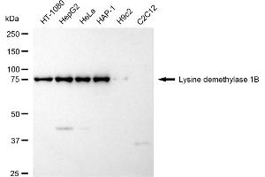 Western blotting analysis using Lysine demethylase 1B antibody (ABIN7799298). (Recombinant KDM1B anticorps)