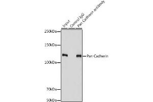 Immunoprecipitation analysis of 900 μg extracts of PC-3 cells using 3 μg Pan Cadherin antibody (ABIN7266233). (CDH1,CDH2,CDH3,CDH4 (AA 800-882) anticorps)