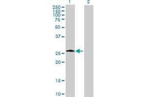 Western Blot analysis of PSPH expression in transfected 293T cell line by PSPH MaxPab polyclonal antibody. (PSPH anticorps  (AA 1-225))