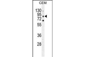 Western blot analysis in CEM cell line lysates (35ug/lane). (CLCN7 anticorps  (C-Term))