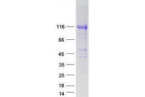 HEATR6 Protein (Myc-DYKDDDDK Tag)