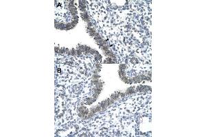 Immunohistochemical staining (Formalin-fixed paraffin-embedded sections) of human lung (A, B) with CCRN4L polyclonal antibody  at 4-8 ug/mL working concentration. (CCRN4L anticorps  (N-Term))