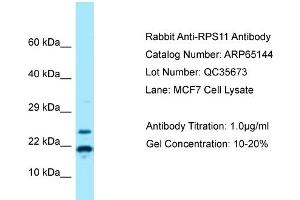 Western Blotting (WB) image for anti-Ribosomal Protein S11 (RPS11) (N-Term) antibody (ABIN2790057) (RPS11 anticorps  (N-Term))