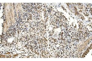 IHC analysis of LSM2 using anti-LSM2 antibody (ABIN7602832).