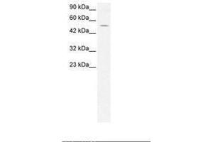Image no. 2 for anti-EVX1 (EVX1) (AA 74-123) antibody (ABIN202451) (EVX1 anticorps  (AA 74-123))