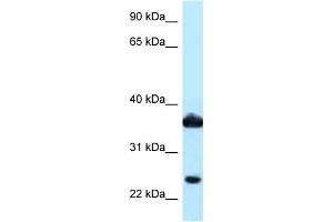 WB Suggested Anti-AKR1C3 Antibody Titration: 1. (AKR1C3 anticorps  (N-Term))