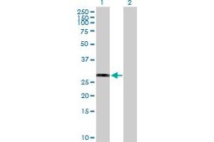 Western Blot analysis of HLA-DRB3 expression in transfected 293T cell line by HLA-DRB3 MaxPab polyclonal antibody.