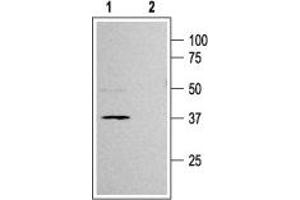 Western blot analysis of rat pancreas membranes: - 1.