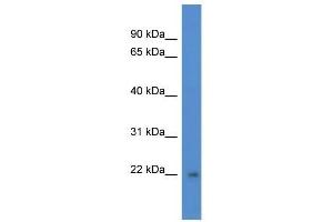 Western Blot showing DGCR6L antibody used at a concentration of 1 ug/ml against Fetal Brain Lysate