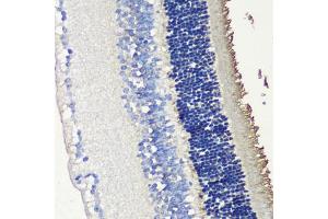 Immunohistochemistry of paraffin-embedded mouse retina using SAG antibody (ABIN6132558, ABIN6147361, ABIN6147362 and ABIN6216887) at dilution of 1:200 (40x lens). (SAG anticorps  (AA 1-405))