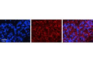 KCNMA1 antibody - C-terminal          Formalin Fixed Paraffin Embedded Tissue:  Human Pineal Tissue    Observed Staining:  Cytoplasm in Human Pineal Tissue   Primary Antibody Concentration:  1:600    Secondary Antibody:  Donkey anti-Rabbit-Cy3    Secondary Antibody Concentration:  1:200    Magnification:  20X    Exposure Time:  0.