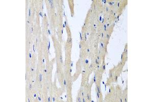 Immunohistochemistry of paraffin-embedded rat heart using PITRM1 antibody at dilution of 1:100 (40x lens). (PITRM1 anticorps)