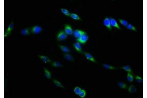 Immunofluorescence staining of Hela cells with ABIN7173817 at 1:133, counter-stained with DAPI. (TNFSF9 anticorps  (AA 52-254))
