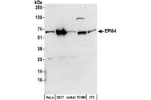 Western Blotting (WB) image for anti-TBC1 Domain Family, Member 10A (TBC1D10A) (AA 458-508) antibody (ABIN7450213)