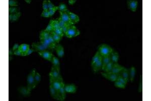 Immunofluorescence staining of HepG2 cells with ABIN7154777 at 1:266, counter-stained with DAPI.