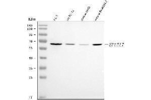 Western blot analysis of SPATA7 using anti-SPATA7 antibody (ABIN7601891).