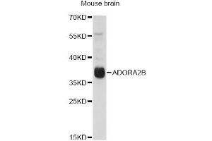 Western blot analysis of extracts of mouse brain, using ADORA2B antibody (ABIN6294005) at 1:1000 dilution. (Adenosine A2b Receptor anticorps)