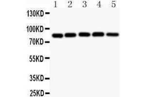 Observed bind size: 85KD (IKK alpha anticorps  (AA 411-745))