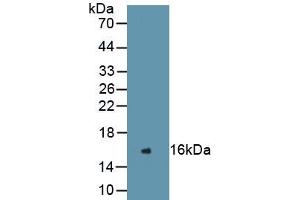 Detection of Recombinant REN, Human using Monoclonal Antibody to Renin (REN)