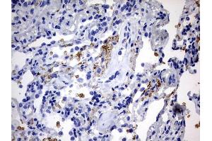 Immunohistochemistry (IHC) image for anti-ATP-Binding Cassette, Sub-Family D (Ald), Member 1 (ABCD1) (AA 508-745) antibody (ABIN2715621) (ABCD1 anticorps  (AA 508-745))