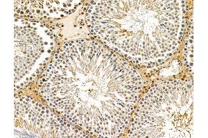 ABIN7095901 and ABIN7099963 at 1/100 staining rat testis tissue by IHC-P. (MED13L anticorps)