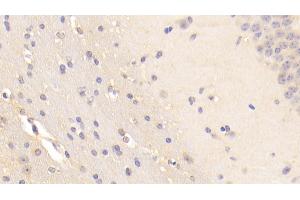 Detection of BFP in Mouse Cerebellum Tissue using Polyclonal Antibody to Brain Finger Protein (BFP)