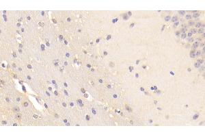 Detection of BFP in Mouse Cerebellum Tissue using Polyclonal Antibody to Brain Finger Protein (BFP) (RNF112 anticorps  (AA 403-647))
