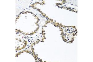Immunohistochemistry of paraffin-embedded human prostate using ARSF antibody at dilution of 1:100 (40x lens). (ARSF anticorps)