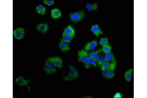 Immunofluorescence staining of MCF-7 cells with ABIN7151921 at 1:133, counter-stained with DAPI.