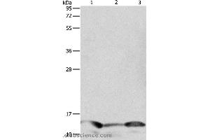 Western blot analysis of Human seminoma tissue, hela and A549 cell, using PFN1 Polyclonal Antibody at dilution of 1:1000 (PFN1 anticorps)