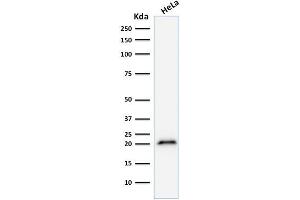 Western Blot Analysis of human HeLa cell lysate using p21 Mouse Monoclonal Antibody (CIP1/823). (p21 anticorps)