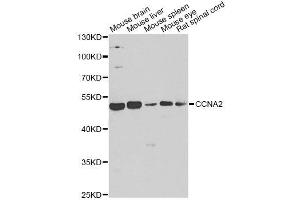 Western blot analysis of extracts of various cell lines, using CCNA2 antibody. (Cyclin A anticorps)