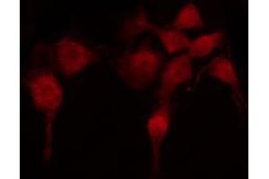 ABIN6268833 staining HuvEc by IF/ICC.