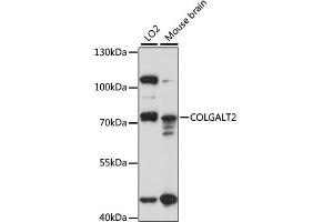 Western blot analysis of extracts of various cell lines, using COLGALT2 antibody (ABIN6294221) at 1:1000 dilution. (GLT25D2 anticorps)