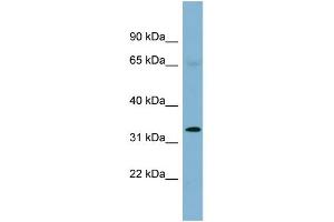 WB Suggested Anti-HEY1 Antibody Titration:  0. (HEY1 anticorps  (Middle Region))