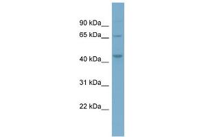 WB Suggested Anti-PIP4K2A Antibody Titration: 0. (PIP4K2A anticorps  (Middle Region))