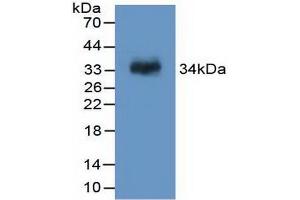 Western blot analysis of recombinant Rat F13A1. (F13A1 anticorps  (AA 140-377))