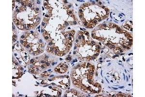 Immunohistochemical staining of paraffin-embedded liver tissue using anti-PASKmouse monoclonal antibody. (PASK anticorps)