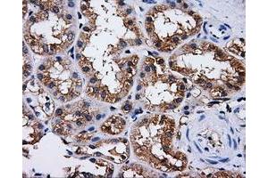 Immunohistochemical staining of paraffin-embedded liver tissue using anti-PASKmouse monoclonal antibody. (PASK anticorps)