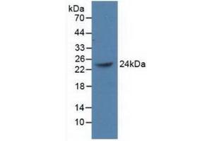 Western blot analysis of recombinant Human PCGF4. (BMI1 anticorps  (AA 152-289))