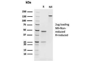 SDS-PAGE Analysis Purified PAX8 Recombinant Mouse Monoclonal Antibody (rPAX8/1492). (Recombinant PAX8 anticorps  (AA 60-261))