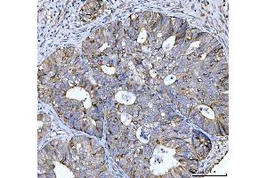 IHC analysis of CCNB1 using anti-CCNB1 antibody (ABIN7599335). (Cyclin B1 anticorps  (AA 1-383))