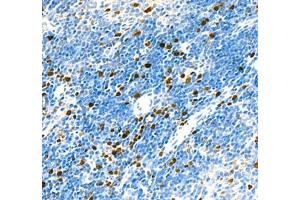 Immunohistochemistry of paraffin embedded rat thymus+LPS using Top2 (ABIN7075937) at dilution of 1:5000 (400x lens)