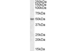 Image no. 1 for anti-TEA Domain Family Member 2 (TEAD2) (Internal Region) antibody (ABIN375139) (TEAD2 anticorps  (Internal Region))
