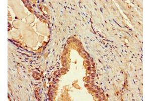 Immunohistochemistry of paraffin-embedded human prostate tissue using ABIN7171658 at dilution of 1:100 (TBC1D7 anticorps  (AA 1-293))